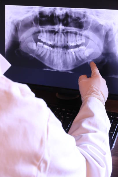 Best Emergency Broken Tooth Repair in Southmont, NC